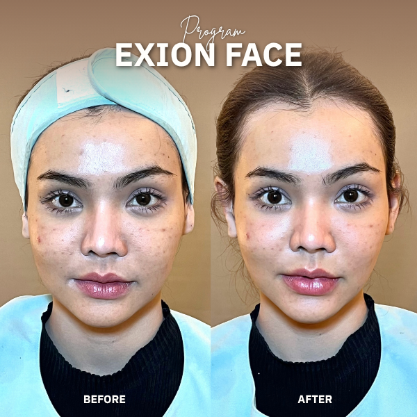 EXION Face