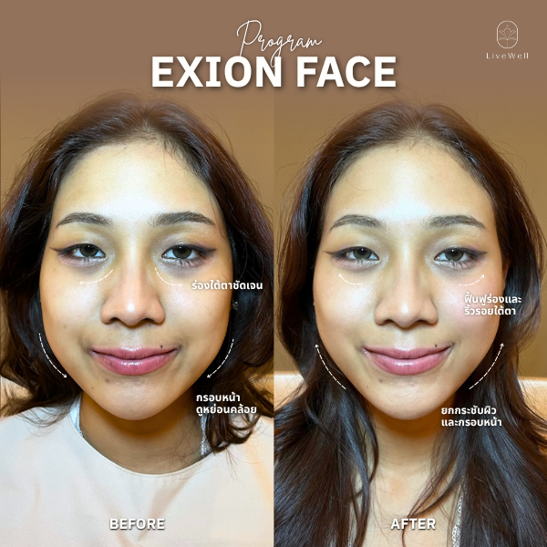 รีวิว EXION Face