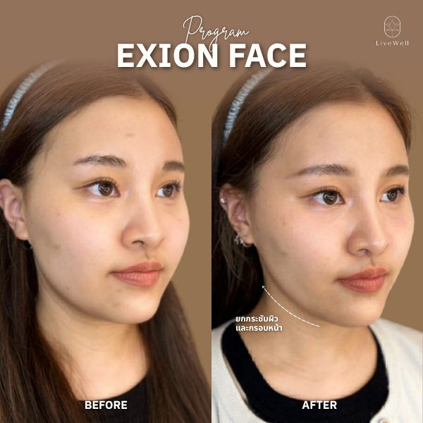 รีวิว EXION Face