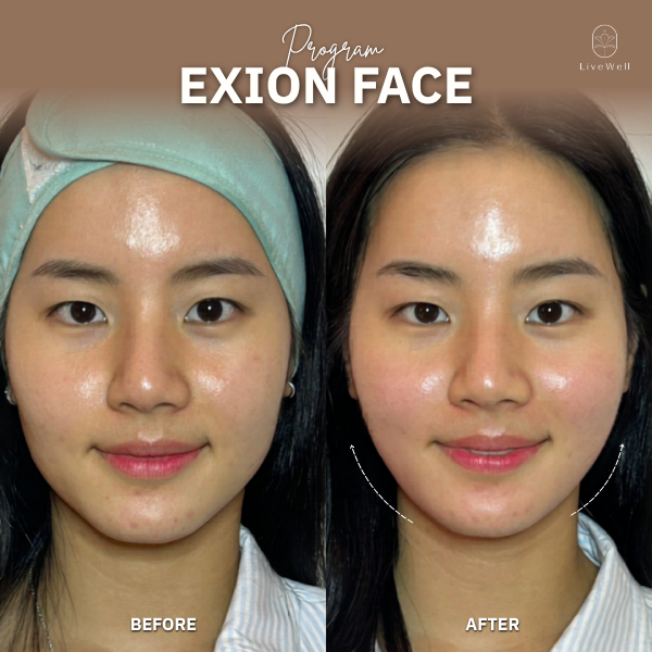 รีวิว EXION Face