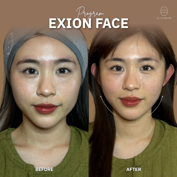 รีวิว EXION Face
