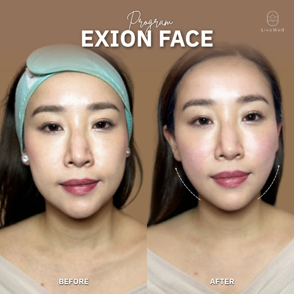 รีวิว EXION Face
