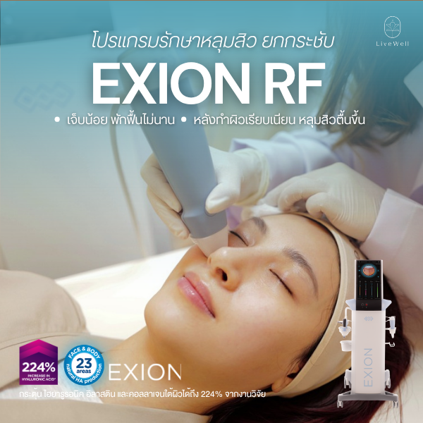 EXION Fractional RF