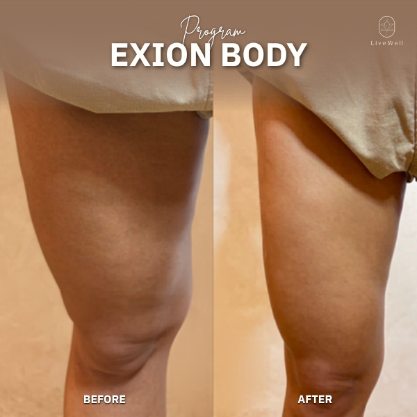 รีวิว EXION Body