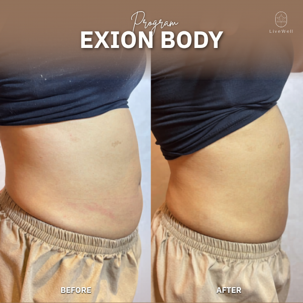 รีวิว EXION Body