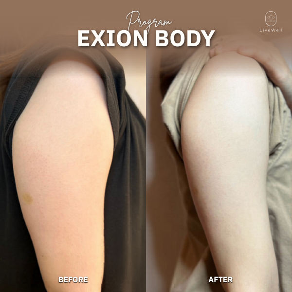 รีวิว EXION Body
