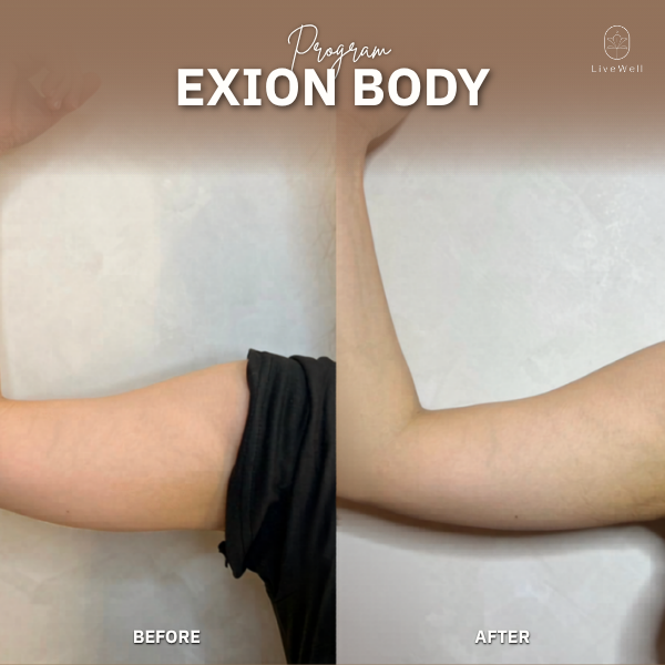 รีวิว EXION Body