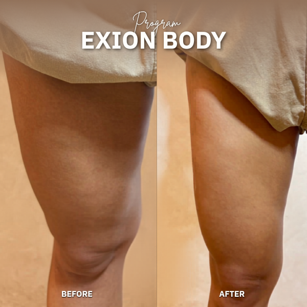 EXION Body