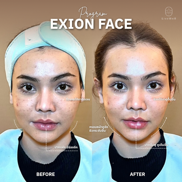 รีวิว EXION Face